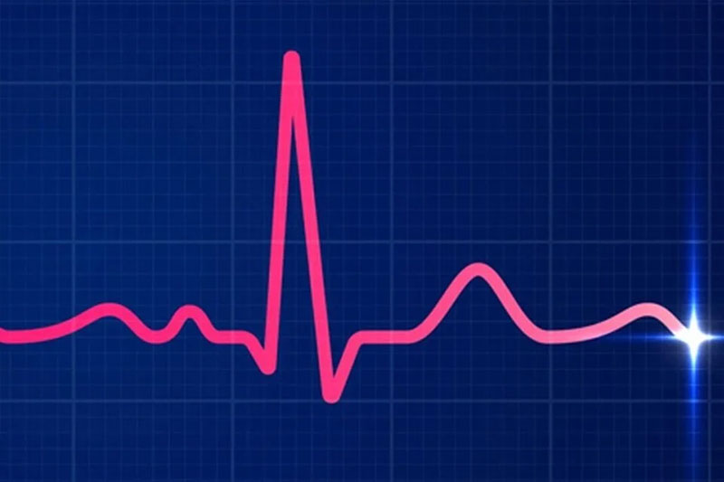 نوار قلب EKG